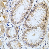 Carboxypeptidase M Rabbit Polyclonal Antibody