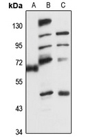 Copine-3 Rabbit Polyclonal Antibody