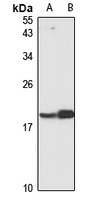 CRCP Antibody