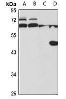 Zhangfei Rabbit Polyclonal Antibody
