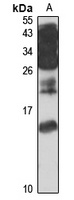 ICAT Rabbit Polyclonal Antibody