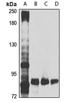 CUX1 Rabbit Polyclonal Antibody