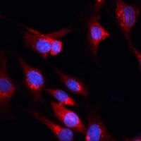 CUX1 Rabbit Polyclonal Antibody