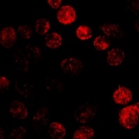 Cytochrome P450 19A1 Rabbit Polyclonal Antibody