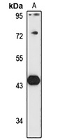 DDI1 Rabbit Polyclonal Antibody