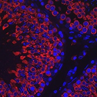 VASA Rabbit Polyclonal Antibody