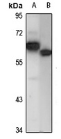 DDX56 Rabbit Polyclonal Antibody