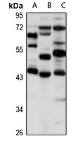 DEK Rabbit Polyclonal Antibody