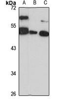 DGCR14 Rabbit Polyclonal Antibody