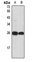 DGCR6L Rabbit Polyclonal Antibody