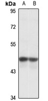 DHH Rabbit Polyclonal Antibody