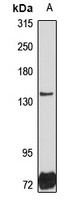DHX29 Rabbit Polyclonal Antibody