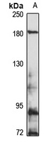 DISP1 Rabbit Polyclonal Antibody