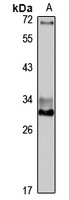 DKK2 Rabbit Polyclonal Antibody