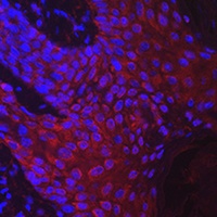 DKK2 Rabbit Polyclonal Antibody