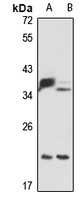 DNAJC12 Rabbit Polyclonal Antibody