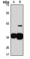 DNAJC9 Antibody