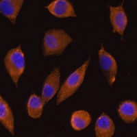DOCK2 Rabbit Polyclonal Antibody