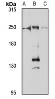 DOCK7 Rabbit Polyclonal Antibody