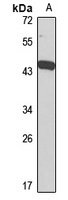 DPEP1 Rabbit Polyclonal Antibody