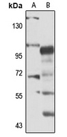 RIP5 Rabbit Polyclonal Antibody