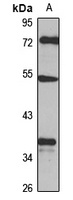 DUSP10 Rabbit Polyclonal Antibody