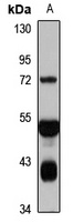 Dishevelled 1 Rabbit Polyclonal Antibody