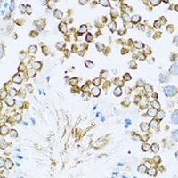 Dishevelled 1 Rabbit Polyclonal Antibody