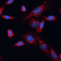 Dishevelled 1 Rabbit Polyclonal Antibody