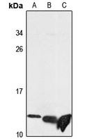 DYNLL1 Rabbit Polyclonal Antibody