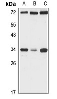 ECH1 Rabbit Polyclonal Antibody