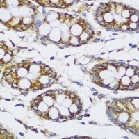 ECH1 Rabbit Polyclonal Antibody