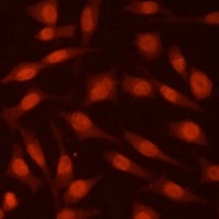 EED Rabbit Polyclonal Antibody
