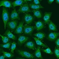 HIF PHD3 Rabbit Polyclonal Antibody