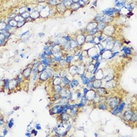 ELP3 Antibody