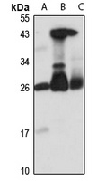 EMC8 Rabbit Polyclonal Antibody