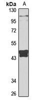 Eme2 Rabbit Polyclonal Antibody