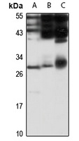 EMG1 Rabbit Polyclonal Antibody