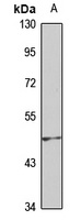 ENPP7 Rabbit Polyclonal Antibody