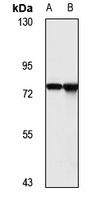 EPB42 Rabbit Polyclonal Antibody