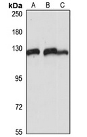 ESYT1 Rabbit Polyclonal Antibody