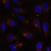 ESYT1 Rabbit Polyclonal Antibody