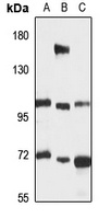E-Syt2 Rabbit Polyclonal Antibody