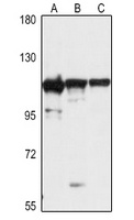 EXOSC10 Rabbit Polyclonal Antibody