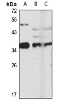 EXOSC7 Rabbit Polyclonal Antibody