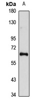 EYA2 Rabbit Polyclonal Antibody