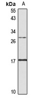 FAAP24 Rabbit Polyclonal Antibody
