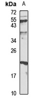 FAIM1 Rabbit Polyclonal Antibody