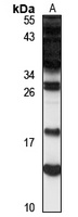 DRR1 Rabbit Polyclonal Antibody