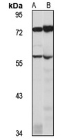 FARSA Rabbit Polyclonal Antibody